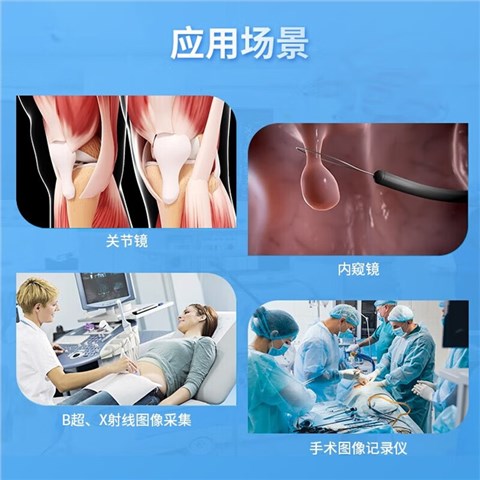 TC-810H 医学录像机 直播录像机